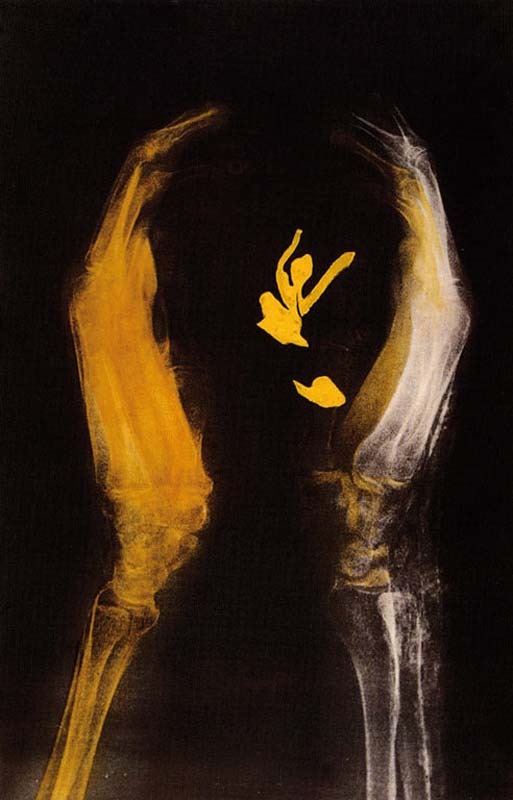 Radiografie