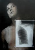 Perugino — Radiografie