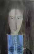 Modigliani — Radiografie