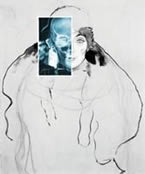 Klimt — Radiografie