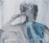 Canova — Radiografie