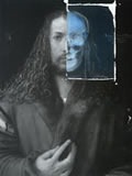 Dürer — Radiografie