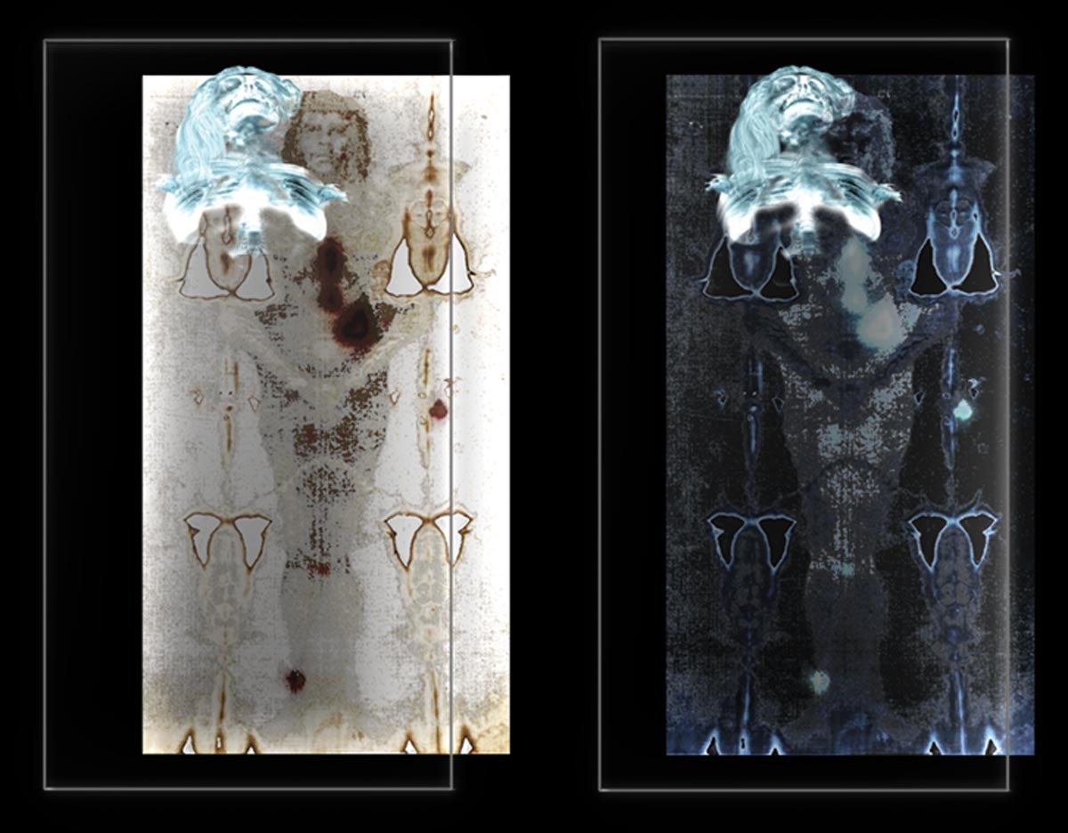 Stacchini — Radiografie